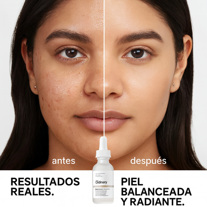 The Ordinary | Niacinamide 10% Zinc 1% - 30mL