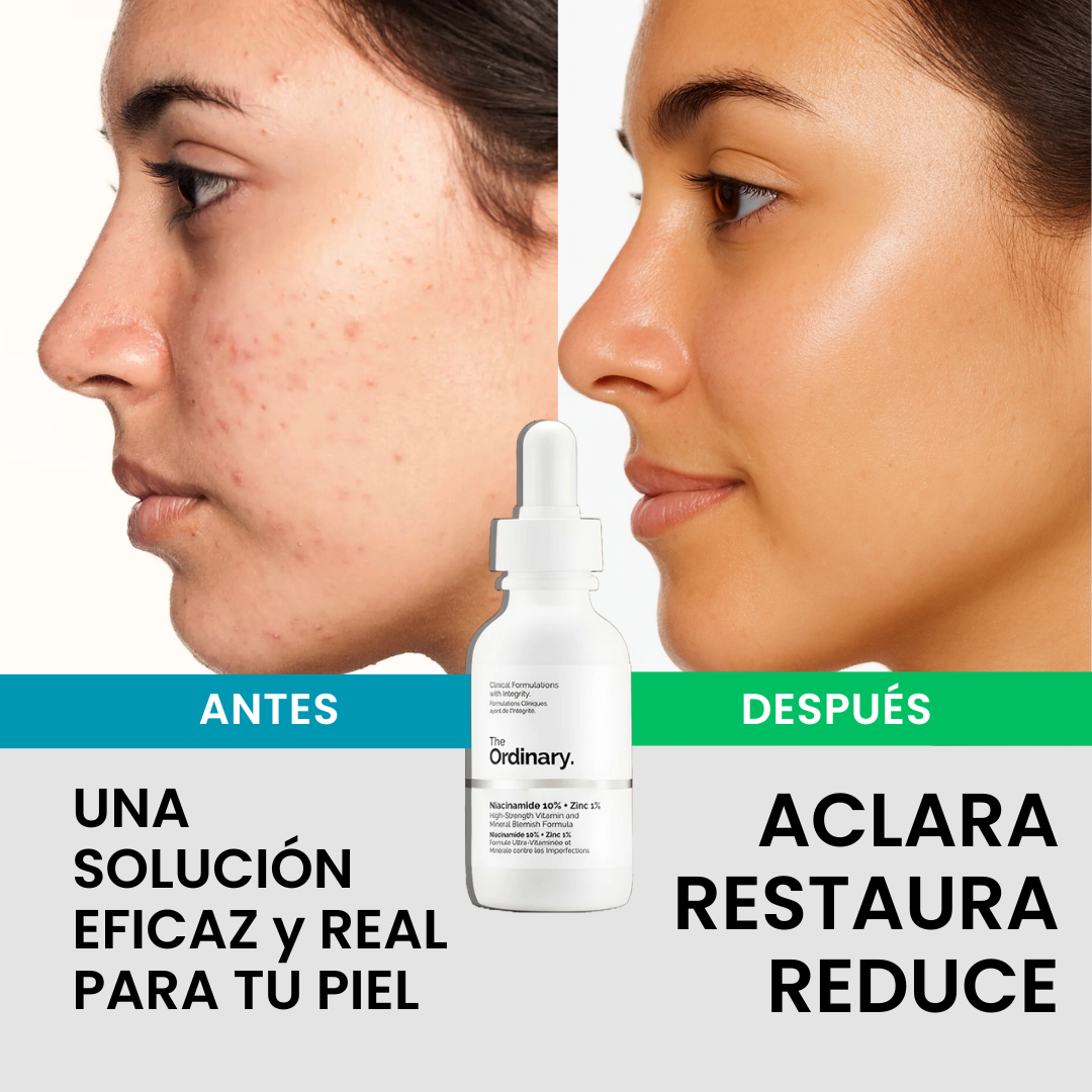 The Ordinary | Niacinamide 10% Zinc 1% - 30mL